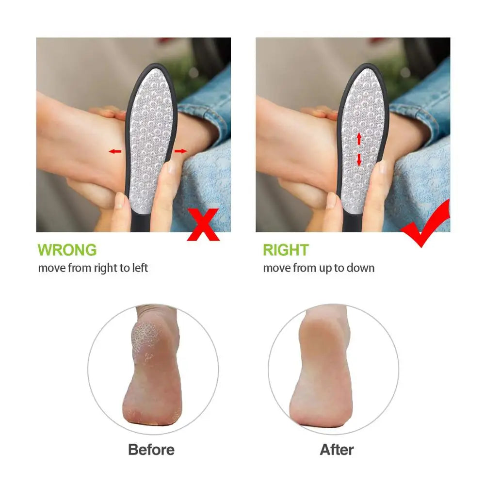 Stainless Steel Double Side Foot Files Hard Skin Pedicure Rasp Scrubber  Callus Remover Grinding Foot Skin Care